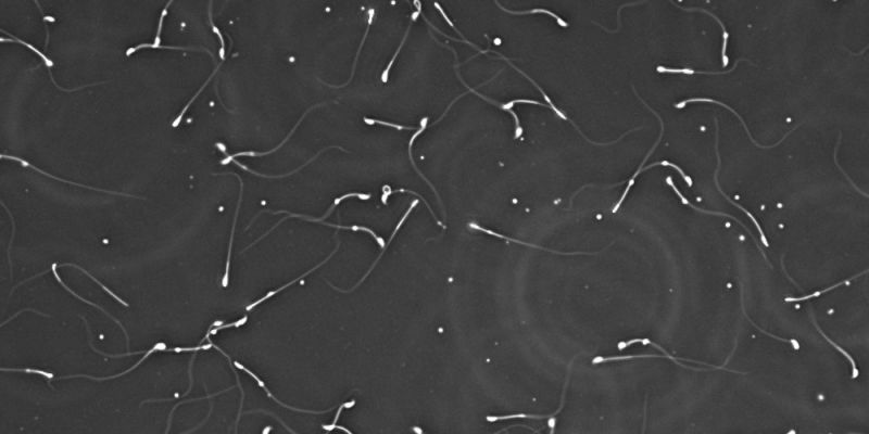 microscope image of mouse sperm